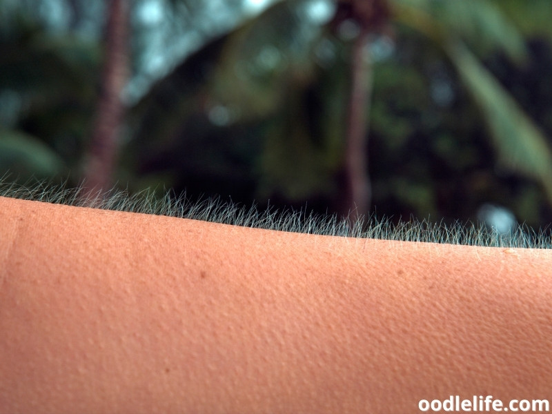 human goosebumps