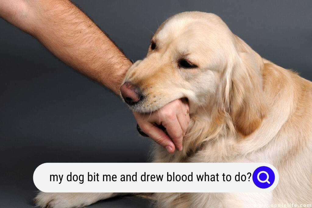 my dog bit me and drew blood